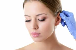 Otoplasty Istanbul patient result Dr Hakkı Izmirli