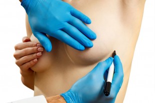 Meme Estetiği - Meme Küçültme