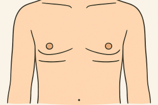 FTM mastectomy