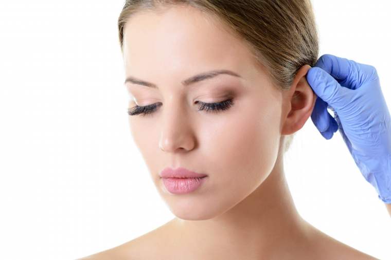 Kepçe kulak estetiği sonrası doğal kulak görünümü – otoplasti ameliyatı örneği